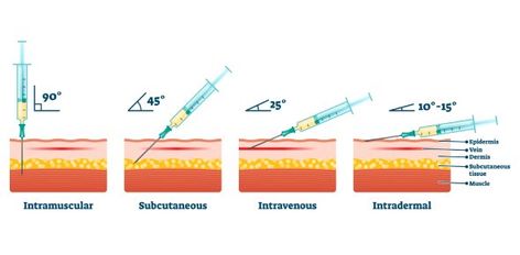 Intradermal Injection, Intravenous Injection, Biceps Brachii, Subcutaneous Tissue, Test Quiz, Hand Hygiene, Editing Software, Nursing School, Immune System