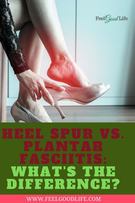 Heel Pain Relief Remedies, Heel Spur Relief, Foot Pain Relief Remedies, Heel Spur, Joints Pain Remedy, Heel Pain Relief, Pain Relief Remedies, Foot Pain Relief, Sciatic Nerve Pain