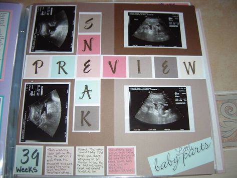 Baby/ultrasound Maternity Scrapbook Pages, Maternity Scrapbook Ideas, Newborn Scrapbook Ideas, Ultrasound Scrapbook, Scrapbook Baby Book Ideas, Baby Shower Scrapbook, Baby Boy Scrapbook Layouts, Pregnancy Scrapbook, Baby Book Ideas