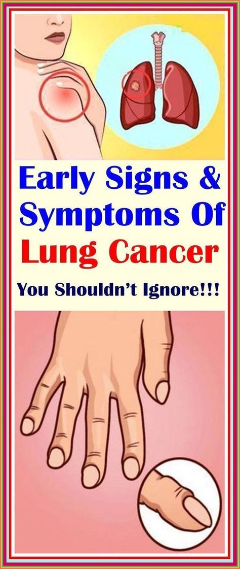 Types Of Cancers, Signs And Symptoms, Lungs, Warning Signs, Health Remedies, Holistic Health, Back Pain, Fitness Tips, Health Tips