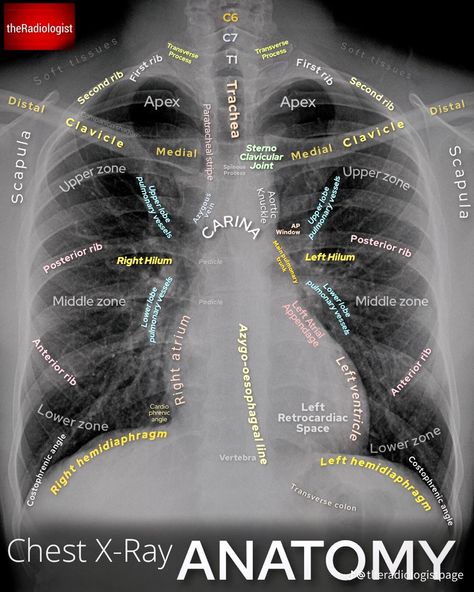 Medical Radiography, Radiology Student, Radiology Technician, Radiology Imaging, Radiology Tech, Medical Student Study, Medicine Student, Medical School Studying, Medical School Essentials