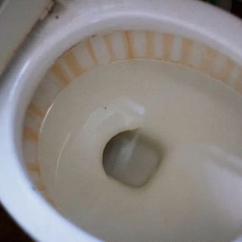 time, cleaning as many stains as you can. If anything remains after this Toilet Bowl Ring, Toilet Ring, Pink Toilet, Water Storage Containers, Pink Slime, Toilet Bowl Cleaners, Dual Flush Toilet, Toilet Bowl Cleaner, Red Stain