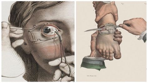 Morbidly Beautiful Illustrations Reveal The Horror Of Surgery In The 15th–19th Centuries Humphry Davy, Surgical Procedures, Human Anatomy Art, Vintage Medical, Medical Aesthetic, Inventors, Arte Sketchbook, Medical Illustration, Anatomy Art