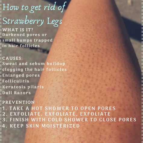 Bumpy Skin On Legs How To Get Rid, How To Get Rid Of Strawberry Skin Diy, How Do You Get Rid Of Strawberry Skin, How To Get Rid Of Dry Skin On Legs Tips, Strawberry Hands Remedy, How To Clear Strawberry Legs At Home, How To Keep Legs Smooth Longer, How To Get Rid Off Strawberry Skin, How To Get Rid Of Dry Leg Skin