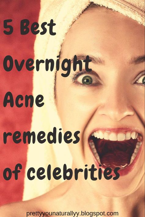 Clearing Acne Overnight, Diy Zit Remover Overnight, Clear Up Skin Fast, How To Get Rid Of Back Acne Overnight, How To Clear Pimples Overnight, Pimple Remedies Overnight How To Get Rid, How To Clear Your Skin Overnight, How To Clear Skin Overnight, How To Have Clear Skin Overnight