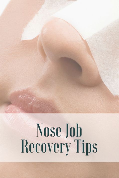 Rhinoplasty Recovery Timeline, Nose Job Recovery, Plastic Surgery Recovery, Rhinoplasty Recovery, Nose Surgery Rhinoplasty, Nose Fillers, Rhinoplasty Nose Jobs, Rhinoplasty Surgery, Eyelid Lift