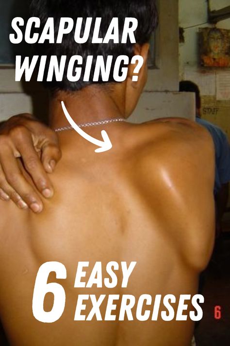 Winging of scapula is a rare condition in which the affected side scapula protrudes away from the body. The sufferer of this rare condition affects the ability to pull, push heavy objects, and lift objects and it also hampers daily activities such as brushing hair and teeth and carrying grocery bags. For some, it also concerns them cosmetically. However, exercise has been found to be effective in managing this kind of disability. Winged Scapula Exercises, Scapular Winging, Scapula Exercises, Winged Scapula, Scapula Bone, Brushing Hair, Wall Push Ups, How To Help Nausea, Elbow Pain