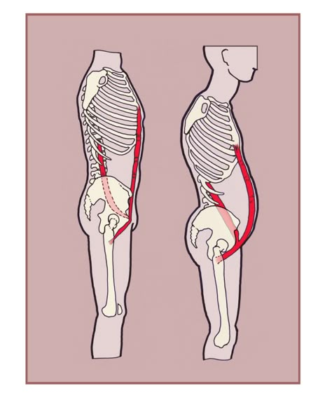 pot-belly Psoas Major, Psoas Iliaque, Punkty Spustowe, Rectus Abdominis Muscle, Psoas Release, Pot Belly, Yoga Anatomy, Posture Exercises, Spine Health