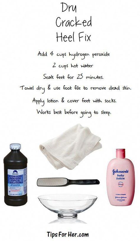 Dry Cracked Heels, Cracked Heel, Cracked Heels, Beauty Remedies, Hydrogen Peroxide, Homemade Beauty Products, Health And Beauty Tips, Beauty Treatments, Simple Tricks