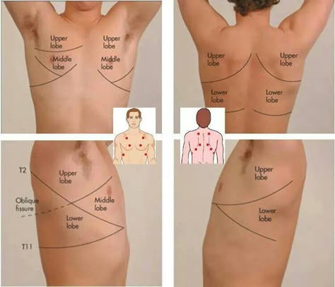 Lung Fields... respiratory Lung Sounds, Nursing Information, Nursing Assessment, Pa School, Nursing School Survival, Nurse Rock, Nursing Life, Respiratory Care, Respiratory Therapy