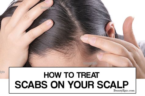 How to Get Rid of Scabs on Scalp - What it is, Causes and How to Treat Scabs On Scalp, Scalp Scabs, Sores On Scalp, Dry Scaly Skin, Vinegar For Hair, Hair Tea, Scalp Problems, Coconut Oil Hair Mask, Breaking Hair