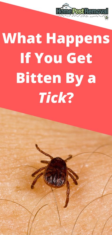 If you’ve stayed away from hiking, camping, and other outdoor activities because you’re afraid of getting a tick bite, that’s understandable. Ticks can transmit a variety of diseases. But, it’s not the end of the world if you do get bitten, so long as you’re able to catch it sooner rather than later. What happens if you get bitten by a tick? Tick Bites Pictures, Tick Bite Symptoms, Deer Tick Bite, Fever Symptoms, Deer Ticks, Tick Bite, Cramps Relief, Mosquito Bite, Bug Bites