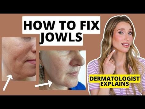 How to Fix Jowls: Dermatologist Explains How to Prevent & Get Rid of Jowls | Dr. Sam Ellis - YouTube How To Reduce Sagging Jowls, How To Get Rid Of Saggy Jowls, How To Get Rid Of Jowls Naturally, Get Rid Of Jowls The Face, Jowel Exercises Face, How To Get Rid Of Jowls, Jowls Sagging, Jowl Exercises, Facial Exercises For Jowls