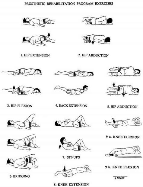 Fig 23-4. Residual-limb strengthening exercise | O&P Digital Resource Library Exercises Without Weights, Below The Knee Amputation, Exercise Without Weights, Physical Therapist Assistant, Leg Exercise, Hip Exercises, Home Exercise Program, Occupational Therapy Activities, Therapy Exercises