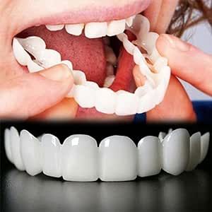 Snap On Smile, Teeth Covers, Temporary Tooth, Veneers Teeth, Loose Tooth, False Teeth, Fake Teeth, Teeth Braces, Yellow Teeth