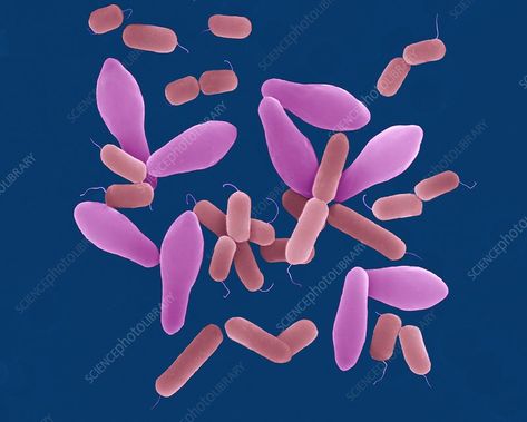 Clostridium perfringens, bacterium, SEM - Stock Image - C032/2632 - Science Photo Library Clostridium Perfringens, Scanning Electron Micrograph, Library Website, Science Photos, Cell Membrane, Buy Prints, Photo Library, Anatomy, Stock Images