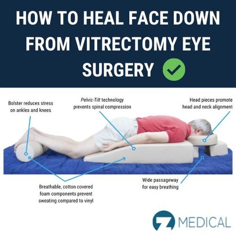 Vitrectomy Surgery, Retina Surgery, Pelvic Tilt, Types Of Eyes, Eye Surgery, Surgery Recovery, Medical Design, What To Use, Face Down