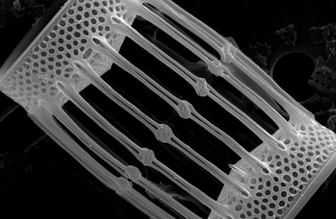 A diatom known as Skeletonema, from Florida.  Image by FWC--Fish & WIldlife Research Institute. Microscope Images, Microscope Pictures, Electron Microscope Images, Scanning Electron Microscope, Scanning Electron Micrograph, Natural Form Art, Microscopic Images, Electron Microscope, Slide Show