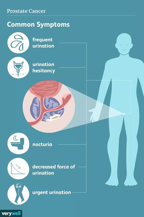 Enlarged Prostate: Symptoms, Causes, and More Low Thyroid Remedies, Libido Boost For Men, Thyroid Remedies, Prostate Health Men, Libido Boost, Low Thyroid, Frequent Urination, Signs And Symptoms, The Signs