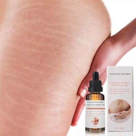 Best fomula stretch marks essential oil scar oil 100��natural pure plant extract 7 days stretch mark removal oil private label https://m.alibaba.com/product/1600460117153/Best-fomula-stretch-marks-essential-oil.html?__sceneInfo={"cacheTime":"1800000","type":"appDetailShare"} Best Stretch Mark Removal, Stretch Mark Oil, Stretch Mark Removal Cream, Oils For Scars, Massage Cream, Stretch Mark Removal, Stretch Mark, Firming Cream, Scar Removal