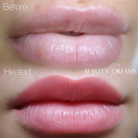 Before and healed Lip Blush Tattoo #permanentmakeup #lips #beautytips #healedtattoo Tattooed Lips Before And After, Lip Blush Tattoo Before And After, Lip Blushing Tattoo Before And After Colors, Lip Shading Tattoo, Lip Shades For Fair Skin, Healed Lip Blush, Lip Blushing Tattoo Healing, Lip Blushing Before And After, Lip Tattoo Cosmetic