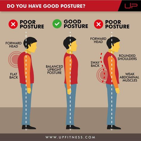 Fix Posture, Posture Correction Exercises, Fix Your Posture, Forward Head Posture, Strength Exercises, Posture Exercises, Muscle Imbalance, Bad Posture, Body Posture