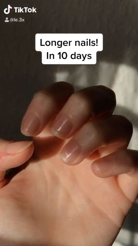 How To Make Nails Stronger Natural, How To Make Longer Nails, Things To Help Your Nails Grow, Tips To Make Your Nails Grow Faster, How To Make Your Nails Stronger And Grow, At Home Nail Growth, How To Get Healthier Nails, What Helps Nails Grow, What Helps Your Nails Grow Faster