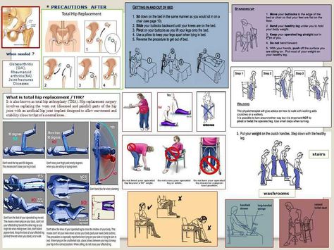 Post operative Physiotherapy after total hip replacement surgery Hip Precautions, Occupational Therapy Kids, Occupational Therapy, Physical Therapy, Surgery, Medicine, The Balm