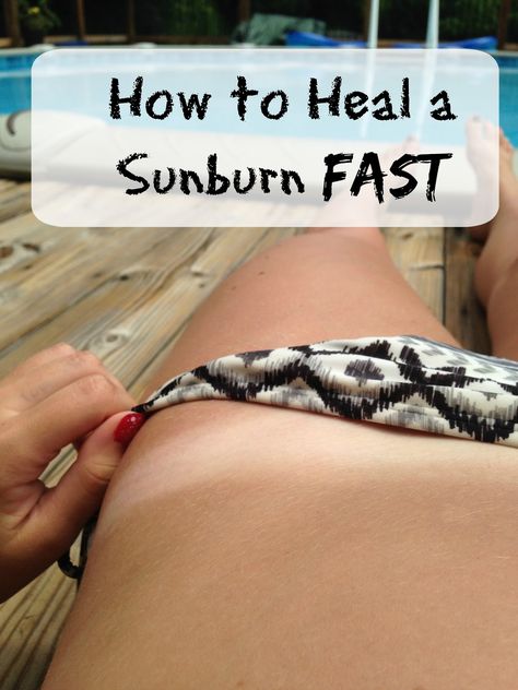 Accidentally get burnt and need a way to heal it fast? Click to find out how to heal your sunburn overnight! Heal Sunburn Overnight, Sun Burn Remedy Overnight, Burn Remedy, Heal Sunburn, Burn Relief, Sunburn Remedies, Sun Burn, Natural Remedy, Home Remedies