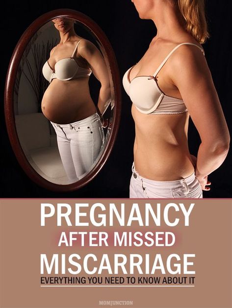 Early Signs Of Pregnancy, 2 Angels, Pregnancy After Loss, Chances Of Pregnancy, Pregnancy Calculator, Losing A Baby, Get Pregnant Fast, Mom Junction, Pregnancy Loss