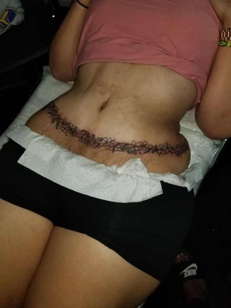 #Abdominoplasty #tattoo #abdomen Abdomen Tattoo, Crop Tops, Tattoos, Women's Top