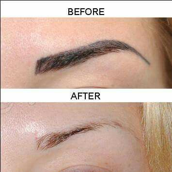 Semi permanent makeup removal Permanent Makeup Removal, Semi Permanent Makeup, Makeup Removal, Microblading Eyebrows, Permanent Makeup, Semi Permanent, Microblading, Makeup Remover, Eyebrows