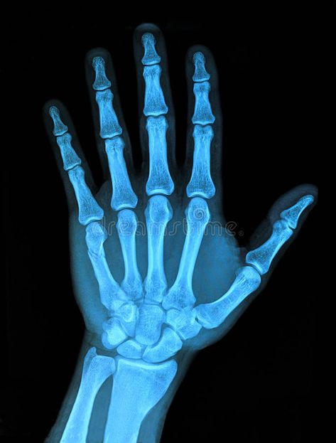 Xray hand. X-Ray Image of right hand , #ad, #hand, #Xray, #Image, #Ray #ad X Ray Aesthetic, Hand Xray, Braille Art, Best Hand Tattoos, Xray Art, X-ray Images, Hand Photography, Medical Background, Hand Images