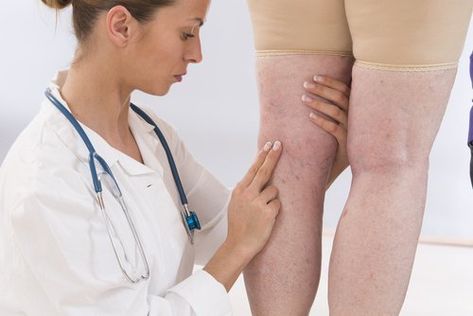 Dans cet article, nous allons vous révéler les 9 ingrédients les plus puissants que vous pouvez intégrer à votre alimentation, pour lutter contre la rétention d'eau. Kwas Moczowy, Varicose Vein Remedy, Anti Dieting, Mayo Clinic, Sciatica, Natural Treatments, Papaya, Back Pain, Natural Remedies