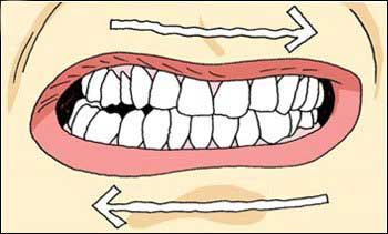 Teeth Problems, Salamanca Madrid, Teeth Grinding, Grinding Teeth, Family Dental, Dental Practice, Ap Art, Salamanca, Dental Health