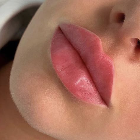 Russian Lips, Lips Inspiration, Facial Fillers, Facial Aesthetics, Lip Filler, Eye Makeup Pictures, Lip Shapes, Lip Injections, Perfect Lips