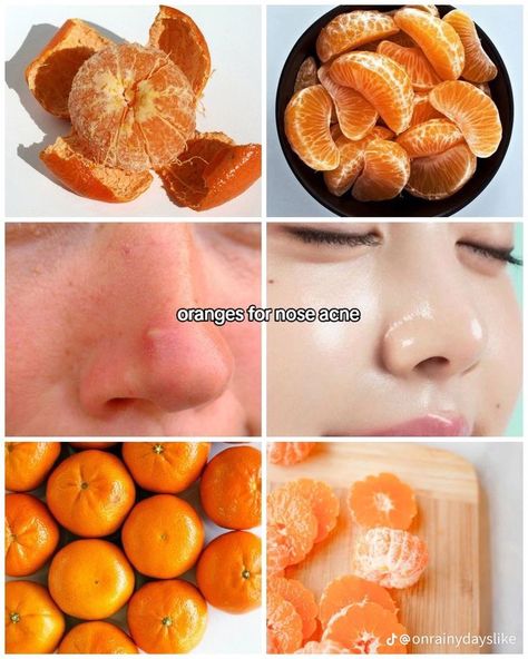 Fruits For Skin, Foods For Clear Skin, Beginner Skin Care Routine, Beauty Treatments Skin Care, Natural Face Skin Care, Good Skin Tips, Basic Skin Care Routine, Clear Skin Tips, Perfect Skin Care Routine