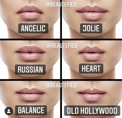 Types Of Lips Shape, Heart Shaped Lips, Lips Inspiration, Lip Types, Face Fillers, Botox Lips, Facial Fillers, Facial Aesthetics, Botox Fillers