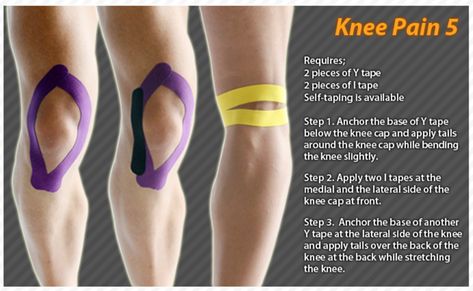 Kinesiology taping instructions for knee pain #ktape #knee #pain #ares Knee Taping, Knee Pain Relief Exercises, K Tape, Kt Tape, Knee Pain Exercises, Kinesio Taping, Kinesiology Taping, Planet Fitness, Knee Exercises