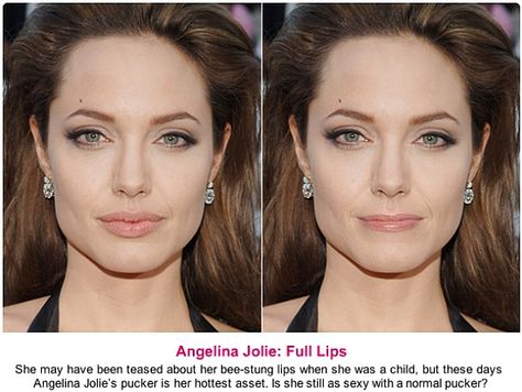 Angelina Jolie photo-edited to have average-sized lips Angelina Jolie Face Shape, Angelina Jolie Lips How To Get, Angelina Jolie Surgery, Botox Eyes, Angelina Jolie Plastic Surgery, Angelina Jolie Smile Teeth, Angelina Jolie Selfie Picture, Angelina Jolie Face Morph, Botox Before And After