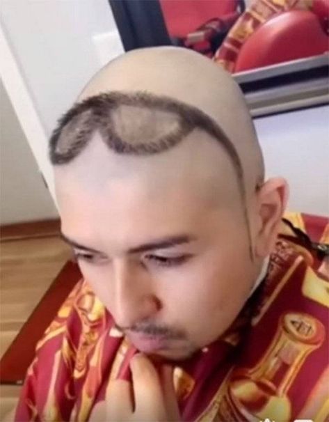 65+ Funniest Haircuts That Will Make You Cringe-07 Horrible Hair, Bald Haircut, Weird Haircuts, Short Hair For Boys, Guy Haircuts Long, Mens Hairstyles Thick Hair, Bad Haircut, Bald Hair, Haircut Designs