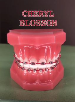 Red Braces Teeth, Red Braces Color, Brace Colors, Power Chain Braces, Dental Braces Colors, Braces Colors Combinations, Tongue Web Piercing, Braces Ideas, Red Braces