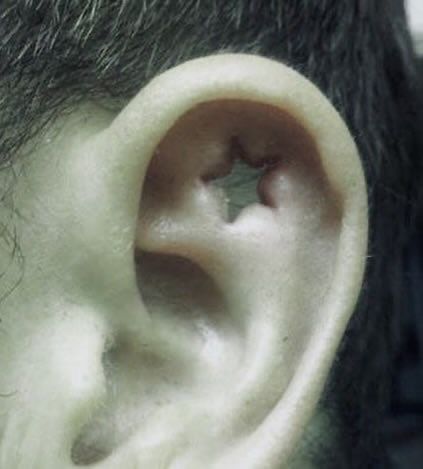 Ear Punch Piercing, Cool Body Mods, Star Eyebrow Piercing, Weird Piercings, Cool Piercings, Cute Piercings, Body Modification, Body Piercings, Body Modifications