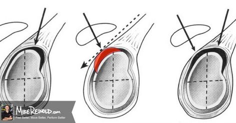 What Exactly Is a SLAP Tear? Top 5 Things You Need to Know Slap Tear Shoulder, Shoulder Injuries, Rotator Cuff, Shoulder Pain, 5 Things, Need To Know, Education