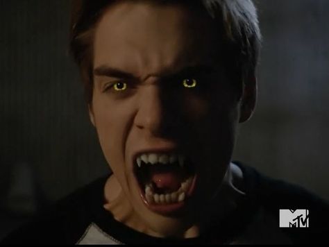 Teen Wolf Liam, Teen Wolf Season 5, Teen Wolf Werewolf, Punched In The Face, Boyfriend Quiz, Liam Dunbar, Teen Wolf Scott, Theo Raeken, Jeff Davis