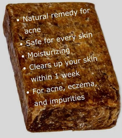 African Black Soap Benefits, Black Soap Benefits, Remedy For Acne, Raw African Black Soap, Melanin Skin, Skin Facts, Skincare Acne, Black Skin Care, Natural Acne Remedies