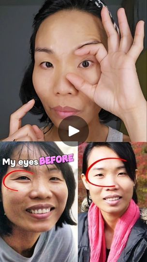 74K views · 3.5K reactions | Despite having small eyes and very drooping eyelids, I have practiced simple eye exercises that have made a significant difference. These exercises have boosted my confidence, allowing me to control my eye appearance, reduce eye wrinkles, and naturally lift my eyelids just the way I want. It’s incredibly powerful!   #eyelidlift #eyeexercise #eyeopener #faceworkout #facialexercise #trinhgeorgg | Trinh Georg | mija_mania · Original audio Eyelid Wrinkles, Reduce Eye Wrinkles, Drooping Eyelids, Small Eyes, Eye Wrinkles, Eyelid Lift, Eye Exercises, Upper Eyelid, Simple Eye