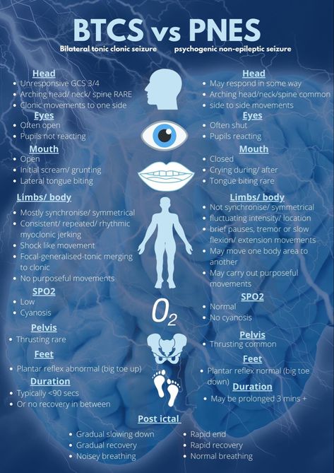 Psychogenic Non-epileptic Seizures, Non Epileptic Seizures, Seizures Nursing, Functional Neurological Disorder, Seizures Non Epileptic, Neurocardiogenic Syncope, Neurology Nursing, Temporal Lobe, Epileptic Seizures