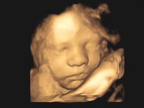 3d Ultrasound Pictures, 3d Ultrasound, 4d Ultrasound, Scheduling App, Custom Stuffed Animal, Baby Products Packaging, Baby Smile, Baby Heartbeat, Baby Smiles