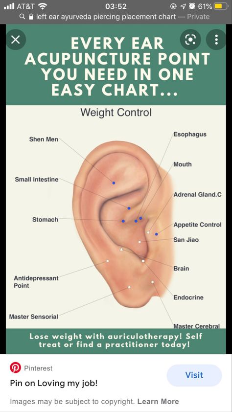 Ear Acupuncture Points, Piercing Pain Chart, Piercing For Migraine Relief, Ear Acupressure Points, Ear Acupressure, Pain Chart, Ear Reflexology, Ear Acupuncture, Ear Seeds